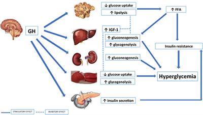 Diabetes Secondary to Acromegaly: Physiopathology, Clinical Features and Effects of Treatment